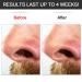 Nose Wax Kit for Men & Women - Hair Removal for Nose & Ear - 50g Wax Beads, 20 Applicators, 10 Paper Cups, 10 Mustache Guards - Buy Online on GoSupps.com