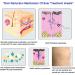 Longmed Silicone Scar Sheets for C-Section Keloid & Acne Scar Removal - 4 Pack 7 x 1.57 - Healing Strips & Sheets - Gel Tape & Cream Alternative - Buy Online on GoSupps.com