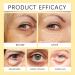 Temporary Instant Eye Tightener Cream: Instant Reduces Under-Eye Bags Instant Eye Lift. Instantly Removes Bags Dark Circles Puffiness Firming Delicate skin -30ml (2) - Buy Online on GoSupps.com