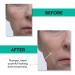 Clark's Botanicals Retinol Rescue Overnight Cream - Hyaluronic Acid & Vitamin C for All Skin Types | 60ml - Buy Online on GoSupps.com