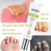 2PCS Nail Repair Essence Cream - Restores Discolored/Damaged Nails - Toe Beauty Cream for Toenail Care - Buy Online on GoSupps.com