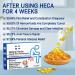 Hhkuize Heca Natural Herbal Hemorrhoid Capsules - Hemorrhoid Shrinking Treatment - 5PCS - Buy Online on GoSupps.com