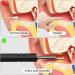 Ear Wax Removal Smart Visual Ear Cleaner with Otoscope 1296P HD Camera 6 LED Light Cleaning Earwax Remover Tool with Multi Replacement Tips Ear Cleaner B - Buy Online on GoSupps.com