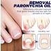 Nankoyal German toenail care removal paronychia oil 3 pack German toenail care oil for removing paronychia toenail correction drops nail renewal fluid for - Buy Online on GoSupps.com