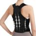 Back Brace Posture Corrector For Men And Women Back Straightener Posture Corrector Adjustable Back Posture Belt Alleviate Back Pain Hunchback And Scoliosis Posture Corrector Kyphosis Medium