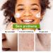 98% Organic Aloe Vera Moisturizer Facial Cream | Anti-Wrinkle & Hydrating for Dry Skin & Acne Scars - Buy Online on GoSupps.com