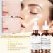 Buy Retinol 1% in Squalane Serum - 30ML Moisturizing Face Serum for Fine Lines & Acne - Best for Dry Skin - Buy Online on GoSupps.com