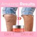 Enaskin Naturals Anti-Cellulite Cream: Firming Solution for Booty Legs & Belly - Skin Tightening & Lifting Body Mask for Toning Lift & Firm Moisturizing Bum Bum Care - Buy Online on GoSupps.com