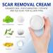 50ml Skin Repair Stretch Mark & Scar Removal Cream - Effective Surgery, Injury & C-Section Scar Lightening Treatment & Toenail Clippers Removal Solution - Buy Online on GoSupps.com