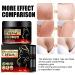 Cr me pour varices limination des varices r parateur de varices cr me pour varices jambes varices enflamm es 20 g 1 pi ce - Buy Online on GoSupps.com