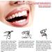 70PCS Temporary Tooth Crown Repair Kit - Fake Front Tooth Replacement Denture Set for Oral Care - Buy Online on GoSupps.com