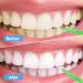 Magrimaxio Interdental Brushes - 50 Pieces in 5 Colors | Reusable Dental Cleaner in Multiple Sizes for Narrow Gaps - Buy Online on GoSupps.com