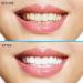 Professional Strength Teeth Whitening Strips 28 Count - 14 Day Supply + Bonus Shade Guide | Shop Now - Buy Online on GoSupps.com