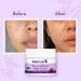 WishCare Collagen Boosting Advance Repair Night Cream With Retinol Niacinamide Grape Seed Sea Algae Jojoba & Rosehip For AntiAging Skin Firming & Plumper Skin 50 gm WARNC50 - Buy Online on GoSupps.com