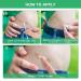 Tobcharm Keloid Scar Removal Gel - Effective Treatment for Piercing Bumps, Stretch Marks, and Surgical Scars | 30g Silicone Gel - Buy Online on GoSupps.com