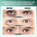 Green Tea Under Eye Patches - 30 Pairs Matcha Eye Mask with Hyaluronic Acid for Dark Circles & Puffiness - Anti-Aging Treatment Gel - Buy Online on GoSupps.com