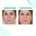 Buy Serious Skincare Glycolic Cleanser 4 oz - Exfoliating Face Wash for Radiant Skin | International Shipping - Buy Online on GoSupps.com