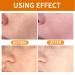 Facial Exfoliating Gel Miss season Skin Exfoliation Purifying Exfoliating Gel Face and Body Exfoliation Scrub Moisturizing Exfoliator for All Skin (1pcs orange) 1pcs 2.09 Ounce (Pack of 1) - Buy Online on GoSupps.com