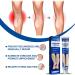 Varicose Veins Cream - Treatment for Leg Spider Vein Relief and Healing - Buy Online on GoSupps.com