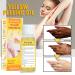 Extra Strength Yellow Peeling Oil 30ML - Lighten Dark Spots, Brighten Complexion - For Face & Body - Suitable for Dark Skin - Buy Online on GoSupps.com