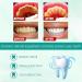 SP-6 Toothpaste - Whitening & Stain Removal Probiotic Formula for Healthy Teeth & Gums - Deep Cleaning Care - 1 PC - Buy Online on GoSupps.com