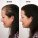 Dark Brown ECLIPSE Hair Fibers 60g - Instantly Conceal Hair Loss - Men & Women - 100% Undetectable - Buy Online on GoSupps.com