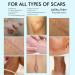 Reusable Medical Grade Silicone Scar Tape - 4cm x 3m Roll for Acne, C-Section, Keloid & Surgery Scars - Buy Online on GoSupps.com