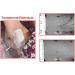 AVX400 Salon Quality Transdermal Electrolysis System - Permanent Hair Removal - Buy Online on GoSupps.com