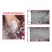 Aavexx 300 Transdermal Electrolysis System - Non Invasive & Highly Effective Home Hair Removal - Buy Online on GoSupps.com
