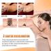 DILUTE Acantho Clear Therapy Spray - Acanthosis Nigricans Treatment for Dark Knuckles & Spots (2 PCS) - Buy Online on GoSupps.com