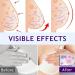Breast Enhancement Patch Natural Lifter & Firming Solution for Sagging Breasts - Buy Online on GoSupps.com