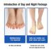 Buy Bunion Corrector & Relief Sleeve - Gel Pads for Men & Women | Fix Hallux Valgus & Restore Toe Shape - Buy Online on GoSupps.com