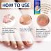 Nail Repair Patches Toenail Patches Ingrown Toenail Treatment Broken Nail Repair Toenail Stickers Toenail Corrector Patch Toe Nail Correct Stickers Comfortable Correction Patch Stickers For Toenail - Buy Online on GoSupps.com