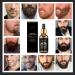 Thesosy Beard Growth Essential Oil | 7-Day Beard Growth Essence for Stylish Beard Care - International Shipping Available - Buy Online on GoSupps.com