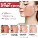 Dark Correcting Serum with 10% Niacinamide & 4% Tranexamic Acid - Treats Post-Acne Marks Scars & Hyperpigmentation for Even Skin Tone - Fragrance-Free Formula. - Buy Online on GoSupps.com