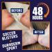Liquid Bandage for Skin | Waterproof & Flexible Wound Care | Heal Cuts Scrapes Burns & Rashes | Instant Protection (5 Sticks - Buy Online on GoSupps.com