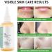 Mikabila 100ml Glycolic Acid 7% Toning Resurfacing Solution Glycolic Acid Toner Moisturize & Strengthen Skin Glycolic Sour 7% Toner Hydrating Toner Rejuvenate Moisturize & Strengthen Your Skin - Buy Online on GoSupps.com