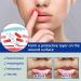 Mouth Ulcer Treatment Spray Oral Ulcer Sprays Ulcer Breath Sprays Canker Relief Spray Canker Sore Treatment Mouth Ulcer Spray Mouth Freshener Spray Breath Spray for Bad Breath Dry Mouth Oral Spray - Buy Online on GoSupps.com