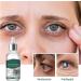 Eye Drops - Eye Repairing Presbyopia Drop | Refreshing Eyies Fatigue Relief | Nano Eyie Droips Suitable For Vision Support Dryness Reilief & Daily Eiyes - Buy Online on GoSupps.com