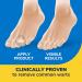Dr. Scholl's ClearAway Wart Remover with Duragel Technology 9ct Clinically Proven Wart Removal of Common Warts with Discreet Thin and Flexible Cushions Optimal for Fingers and Toes - Buy Online on GoSupps.com
