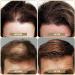 SOVONCARE Hair Fibers for Thinning Hair Black Hair Building Fibers for Bald Spots Undetectable & Natural Conceals Hair Loss Fill In Fine Hair Powder Hair Thicker Instantly for Women & Men 28g (Aubrun) - Buy Online on GoSupps.com