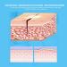 Raguso Zip Stitch Sutures: Noninvasive Skin Closure Device - Waterproof, Breathable, Adjustable - 2pcs for Painless Wound Care - Buy Online on GoSupps.com