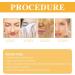 Rejuvenating Honey Tear-Off Mask Honey Nourishing Muscle Tearing Mask Honey Peel-Off Mask Rejuvenating Deeply Cleans Moisturizing Mask Anti-Aging Peel-Off Mask To Reduce Winkles - Buy Online on GoSupps.com