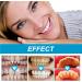 Jelly Cup Mouthwash - Fresh Breath & Oral Health | Eliminates Bad Breath & Cleans Teeth - Buy Online on GoSupps.com