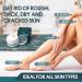 ND Urea 40% Foot Cream - Best Callus Remover for Dry Feet, Hands, Elbows, Knees - Cracked Heel Repair with Socks - Intensive Moisturizer for Rough, Thick, Dry Skin - Buy Online on GoSupps.com