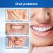 Tooth Whitening Serum - 3 Pieces 30ml | Sensitive Teeth | Fresh Breath Stain Removal & Gum Protection - Buy Online on GoSupps.com