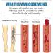 Raura Vein Cream - Raura Varicose Veins Treatment Cream - Buy Online on GoSupps.com