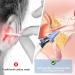 AUSSNICE Electric Ear Wax Removal Kit - Rechargeable Ear Cleaner for Adults & Kids - Ear Irrigation System with Reusable Tips - Buy Online on GoSupps.com