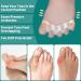 Pack of 10 Gel Toe Separators | Silicone Toe Spacers for Bunions & Correct Alignment | Restore Overlapping Toes - Buy Online on GoSupps.com