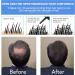 Professional Quality Hair Fibres - Black | Conceals Hair Loss in 15 Seconds | Undetectable & Natural | Women and Men - Buy Online on GoSupps.com